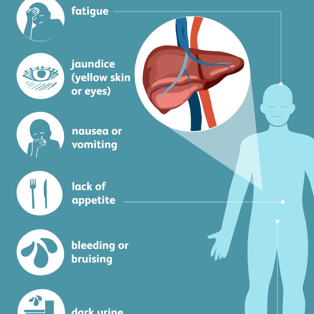 Hepatitis C