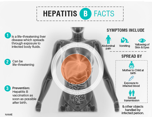 Hepatitis B